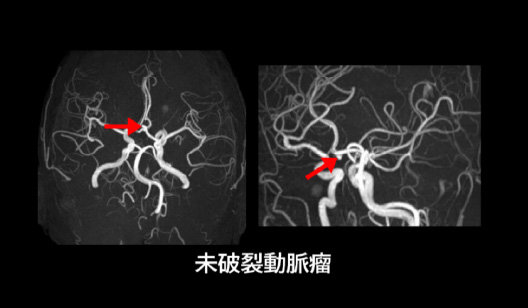 頭部 MRI 画像