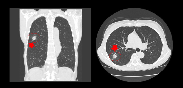 検査例イメージ画像